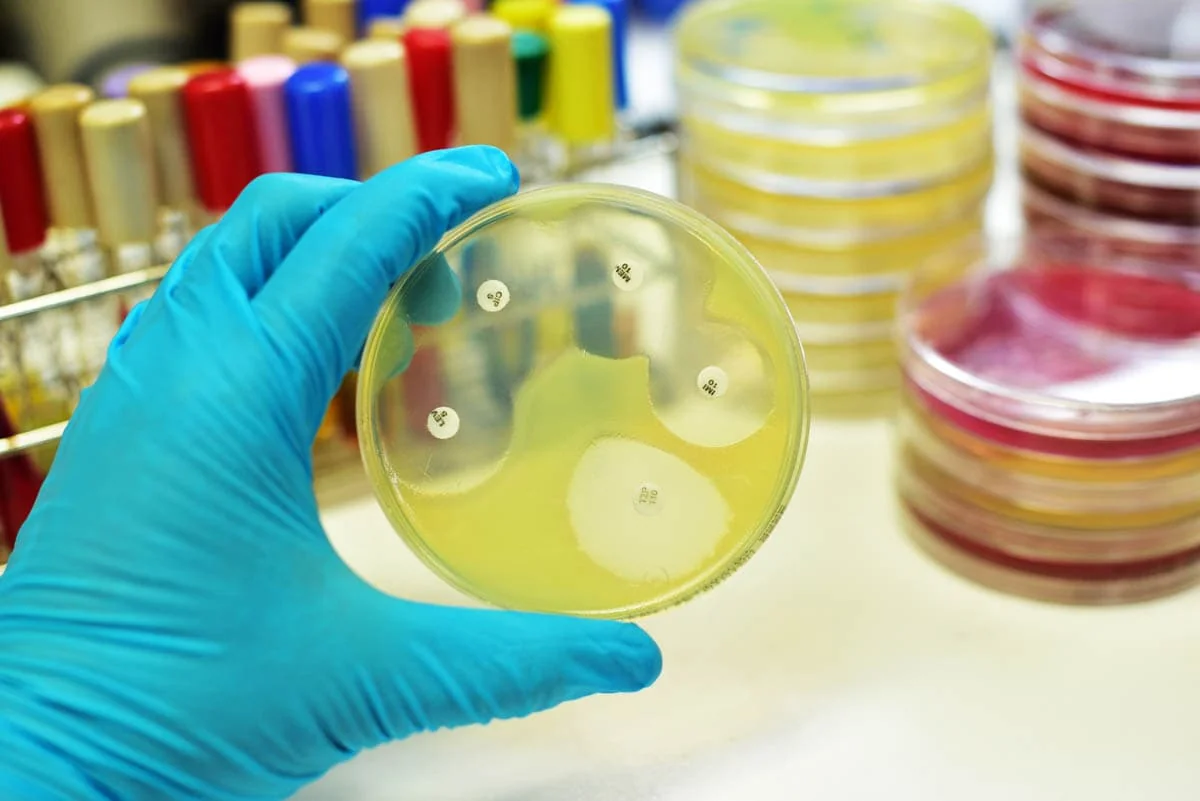 Culture & Antibiotic Sensitivity